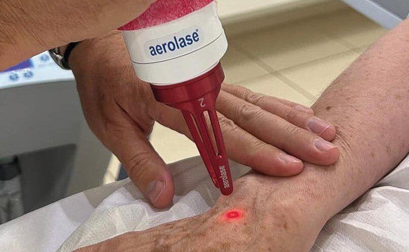 Aerolase HERITAGE Magazine